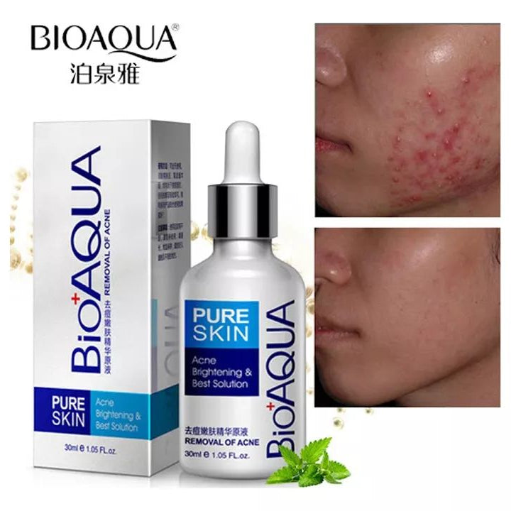 🌟 SUPER COMBO ANTIACNÉ BIOAQUA 🌟